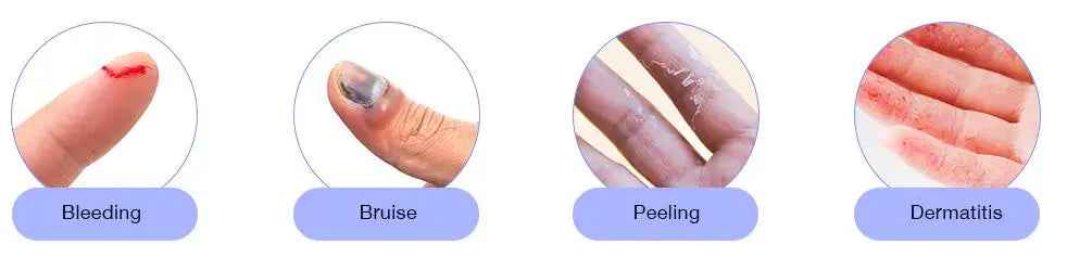 🛡️No More Ouchies! Soft Finger & Toe Sleeves for Your Little Adventurer – 10-Pack - ThiGui